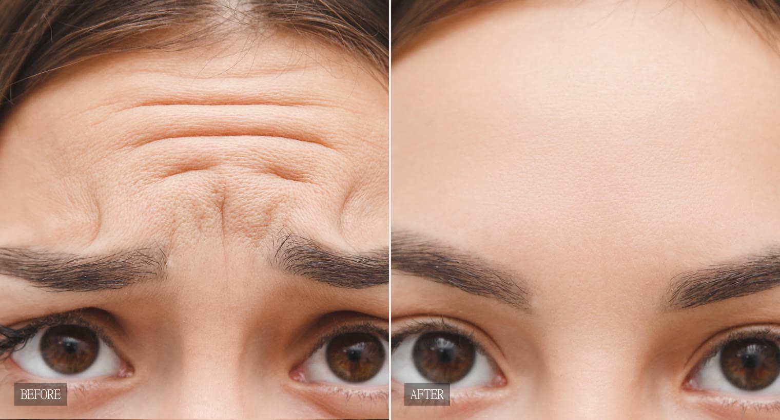 Before and after treatment results shown on the site